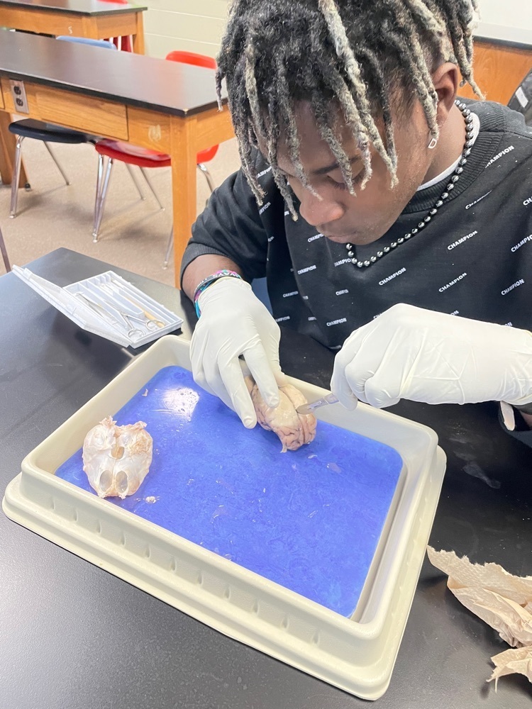 Boy dissecting a sheep brain.